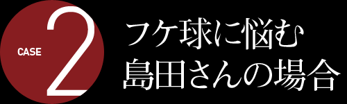 フケ球に悩む 島田さんの場合